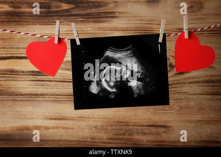 Ecografia dei baby appeso sulla corda Foto Stock