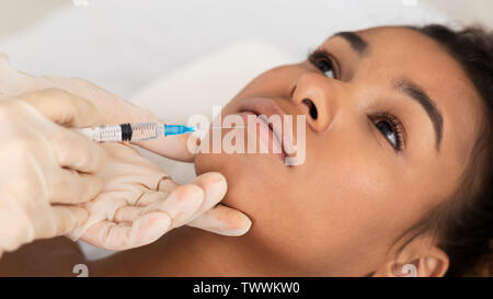 Lip Augmentation. Afro donna riceve l'iniezione di acido ialuronico Foto Stock