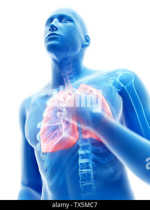 3d reso illustrazione di un uomo avente un'infiammazione del polmone Foto Stock