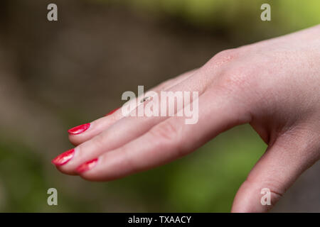 Piccolo segno di spunta sul dito umano, pericolo di tick del morso Foto Stock