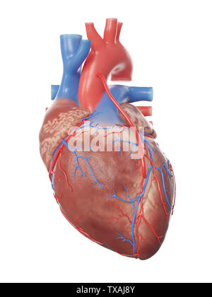 3D Rendering accurato dal punto di vista medico illustrazione di un cuore con un bypass Foto Stock