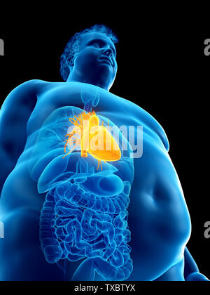 3D Rendering accurato dal punto di vista medico illustrazione di un obeso mans cuore Foto Stock