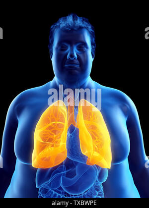 3D Rendering accurato dal punto di vista medico illustrazione di un obeso mans polmoni Foto Stock