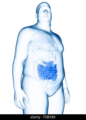 3D Rendering accurato dal punto di vista medico illustrazione di un obeso mans intestino tenue Foto Stock