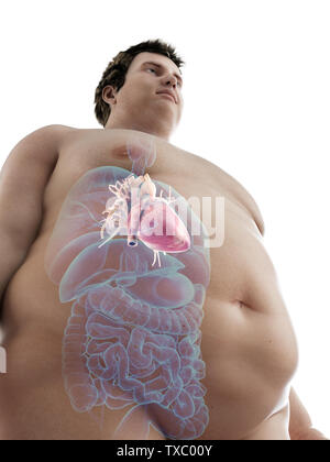 3D Rendering accurato dal punto di vista medico illustrazione di un obeso mans cuore Foto Stock