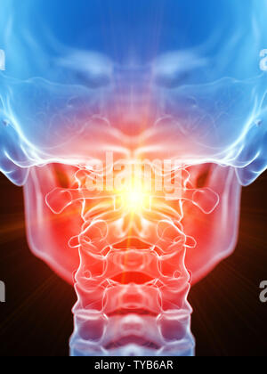 3D Rendering accurato dal punto di vista medico illustrazione della atlas osso mostranti dolore Foto Stock