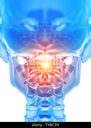 3D Rendering accurato dal punto di vista medico illustrazione della atlas osso mostranti dolore Foto Stock