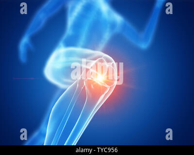 3d reso illustrazione di un jogger ginocchio doloroso Foto Stock