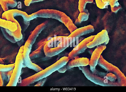 Questo Istituto Nazionale di allergie e malattie infettive (NIAID) immagine, adottate il 12 agosto 2014 utilizzando un formato digitale-colorati scanning electron microfotografia (SEM), raffigura un singolo filamentosi virus Ebola particella. Ebola febbre emorragica Ebola (HF) è uno dei numerosi virale febbri emorragiche. Si tratta di un grave, spesso fatale malattia negli esseri umani e primati non umani. UPI/NIAID Foto Stock