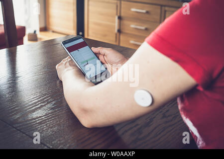 La donna il controllo del livello di glucosio in remoto con la nuova tecnologia del sensore e il telefono cellulare e il controllo dei livelli di glucosio senza sangue. Focus su sfondo. Foto Stock