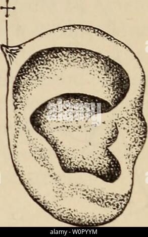 Immagine di archivio da pagina 180 di der Bau des Menschen als. Der Bau des Menschen als Zeugnis für seine Vergangenheit derbaudesmensche00wied Anno: 1902 Geliöroro-au. 169 Die vollständig ursprüngiicli durchgreifenden Spalten zwischen den Knorpel- stücken erhalten sich unvollkommen als Incisurae Santorini. Die mit dem übrigen Ohrknorpel verschmolzene totale, in ihrer Lage der Freien Ohrspitze entsprechende "Spina inferno eis' (Processus spinosus helicis) ist das Homologon eines bei delen Säugern (üngulaten, Karni- voren, Eodentia) selbständigen Knorpelstückes, nämlich des sog. Scutulum (ClyiDeus, Rotul Foto Stock