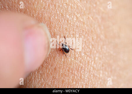 Brown la spunta su una pelle umana con un dito femminile circa per rimuoverlo. Foto Stock