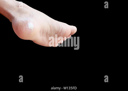 Close up dolore piede isolato di mais su sfondo nero con tracciato di ritaglio Foto Stock