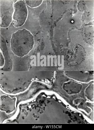 Immagine di archivio da pagina 115 di sviluppo dei metodi cytochemical per l. Sviluppo di metodi cytochemical per lo studio della parete ascospore biogenesis e maturazione . developmentofcyt00lusk Anno: 1991 106 Foto Stock