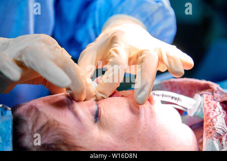 Medico rendendo rinoplastica per signora. Chirurgo palpating femmina naso del paziente Foto Stock