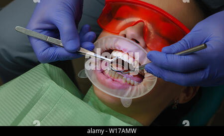 Dentista esamina lo stato dei denti, con l aiuto di strumenti medici nel paziente della ragazza. La reception principale. Dental Clinic. Assistenza sanitaria. Foto Stock