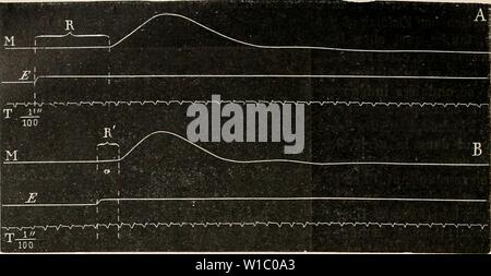 Immagine di archivio da pagina 483 di Dictionnaire de physiologie (1902). Dictionnaire de physiologie . dictionnairedeph05ricco anno: 1902 474 ÃPILEPSIE CORTICALE. reprÃsente une transizione entre la secousse musculaire semplice et l'Ãpilepsie corticale. Pour obtenir des convulsioni Ãpileptiques, il faut appliquer à l'Ãcorce des eccitazioni Fie. 207. Â A. Secousse provoquÃe musculaire par une induite eccitazione unica, appliquÃe Ã la zona mo- trice (muscoli extenseurs du poignet du Chien. Myographe Ã la trasmissione). B. Secousse musculaire pro- voquÃe par la eccitazione mÃªme appliquÃe au nerf moteur; M Foto Stock