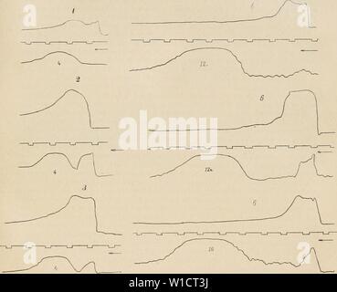 Immagine di archivio da pagina 740 di Dictionnaire de physiologie (1900). Dictionnaire de physiologie . dictionnairedeph04ricco anno: 1900 deglutizione. 731 il fut possibile de dÃterminer l'intervalle de temps ÃcoulÃ entre la compressione des deux ballons, en d'autres termes, la durÃe de la trasmissione de la contrazione jusqu'à l'endroit considÃrÃ de l'Åsophage. Dans chacun des raddoppia tracÃs(i-6) fig.88, onreconnaÃ®tladiffÃrencedesmouvements pharyngien et Åsophagien; la courbe supÃrieure provient du ballon pharyngien, l'infÃ- rieure du ballon Åsophagien. Les chilTres inscrits sur cette derniÃ¨re indiq Foto Stock