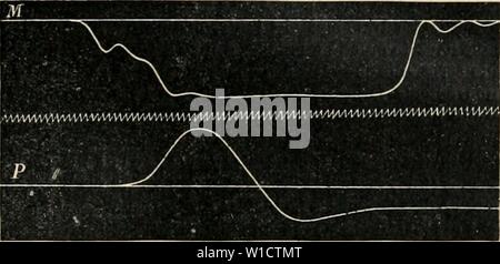 Immagine di archivio da pagina 758 del Dictionnaire de physiologie (1900). Dictionnaire de physiologie . dictionnairedeph04ricco anno: 1900 deglutizione. 749 Frcx. 95. Â Le tracÃ supÃrieur reprÃsente la contrazione du groupe mylohyoÃ¯Jien. Le tracÃ iufÃ¹ricur, celui de la muscolatura aprÃ pharyngÃe¨s l'eccitazione laryngÃ du. La ligne ondulÃe intermÃdiaire in- dique le centiÃ¨uit de seconde. DurÃe 0,08 seconde environ. Nazioni Unite lapin fut IrucliÃototnisÃ, et dans la partie antÃrieui"o de l'Åsopiiae su introduisit l'une des extrÃmitÃs et la branche horizontale d'onu en tubo X, l'ouverture symÃtrique restant Foto Stock