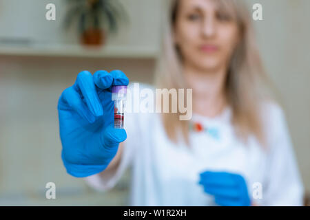 Una donna bionda tecnico di laboratorio prende un campione di sangue con guanti blu. Laboratorio di analisi mediche Foto Stock