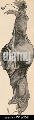 Immagine di archivio da pagina 621 della encyclopaedia - Wikizionario di anatomia e. Il encyclopaedia - Wikizionario di anatomia e fisiologia cyclopdiaofana05todd Anno: 1859 546 utero e le sue appendici. influenza, specialmente durante la gravidanza, su altre parti e organi. Le malattie e gli incidenti di cui è responsabile sono più nu- merous, e sono frequentati da un maggiore pericolo di vita rispetto a quelle che interessano eventuali altre porzioni di queste strutture, mentre i suoi vari stati patologici, come pure la sua condizione naturale, può essere accertato durante la vita con un grado di precisione che praticamente elimina la ute- rus dalla categoria di int Foto Stock