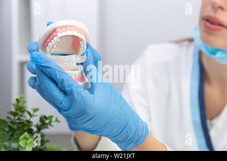 Dentista femmina che mantiene i denti modello e silicone ortodontico trainer. Invisibile allineatore di bretelle. Mobile apparecchio ortodontico per la correzione dentale Foto Stock