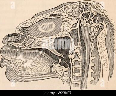 Immagine di archivio da pagina 170 della encyclopaedia - Wikizionario di anatomia e. Il encyclopaedia - Wikizionario di anatomia e fisiologia cyclopdiaofana0402todd Anno: 1849 a questa forma di mostruosità GeofTroy San Ililaire dà il nome di anencephalits. Spe- cimens di esso sono stati trovati tra le mummie egizie nel sacro sepolcri della Cy- nocephaJi e Ibis, che è molto interessante la realtà per quanto riguarda il mostruoso nascite in quei tempi. Terzo tipo. - La superficie di base cranii solo parzialmente, denudata - un tumore spugnoso che occupa il posto del cervello. Il cranio può essere chiuso in corrispondenza della sua parte posteriore e rimangono aperti a Foto Stock