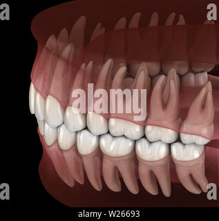 La morfologia della mandibola e del mascellare gengiva umana e denti. Accurata dal punto di vista medico dente 3D illustrazione Foto Stock