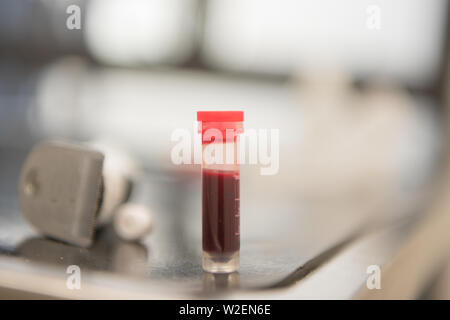 Rosso Sangue di campioni per analisi in un tubo di prova Foto Stock