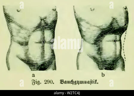 Die Frau als Hausärztin (1911) 290 Bauchgymnastik Foto Stock