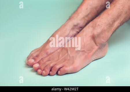 L'uomo sente forte il dolore del piede. La gente, la sanità e la medicina concept Foto Stock