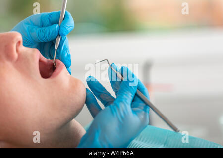 Una femmina di dentista esamina la cavità orale del paziente con un attrezzo con uno specchio. Close-up verticale di un paziente con una bocca aperta, un dottore in Foto Stock