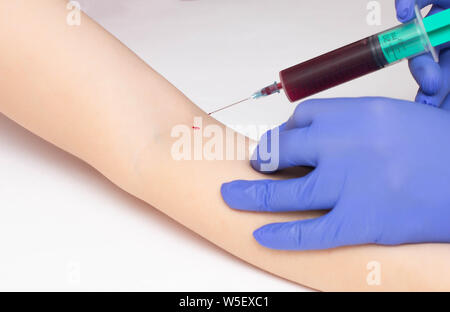 Il medico prende il sangue dalla vena di un paziente a malattie dei parassiti di uovo e Staphylococcus, close-up, testosterone, osteoporosi, lamblia Foto Stock