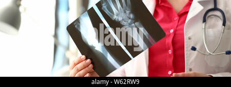 Donna medico tenendo la mano destra osso immagine a raggi X Foto Stock