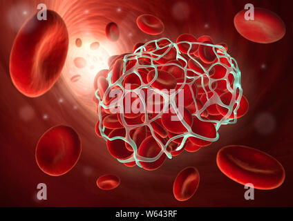 Illustrazione medica di un coagulo di sangue o trombi - coagulazione - 3D illustratio Foto Stock