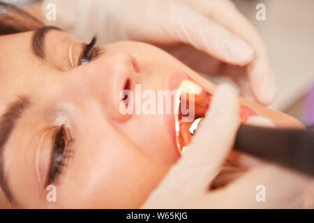 Paziente con il mal di denti e bocca aperta ottiene il trattamento canalare presso il dentista Foto Stock