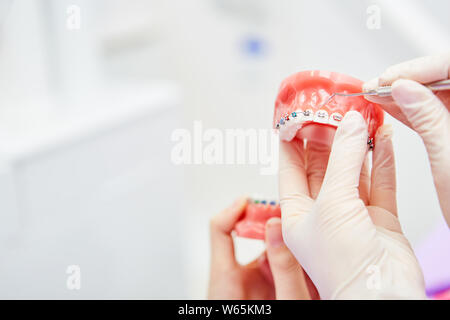 Dentista mostra tutori od ortesi dentale su un modello di dentiera in uno studio dentistico Foto Stock