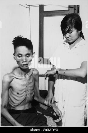 Gli effetti di un solo mese trascorso in un Viet Cong campo di prigionia visualizza il 23-anno-vecchio Le Van a chi aveva difettato da forze comuniste e unite al lato del Governo, è stato ripreso dai Viet Cong e deliberatamente affamate., ca. 1966; le note generali: utilizzo di guerra e di conflitto numero 413 quando si ordina una riproduzione o la richiesta di informazioni su questa immagine. Foto Stock