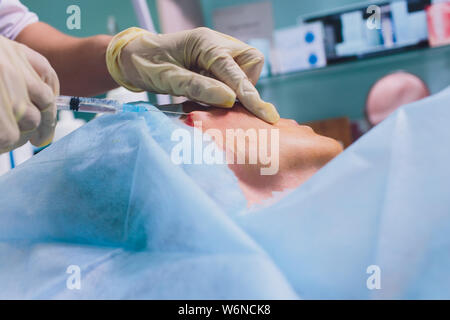 Età della donna facendo mesothreads e filo di sollevamento, cosmetologia. Procedura di personalizzazione per eliminare i segni di invecchiamento. Bellezza Viso, contorno facciale, plastica Foto Stock