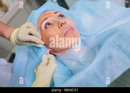 Età della donna facendo mesothreads e filo di sollevamento, cosmetologia. Procedura di personalizzazione per eliminare i segni di invecchiamento. Bellezza Viso, contorno facciale, plastica Foto Stock