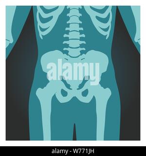 X-ray colpo di bacino e la colonna vertebrale, corpo umano le ossa, radiografia, illustrazione vettoriale. Illustrazione Vettoriale
