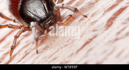 3d reso illustrazione di un tick mordere nella pelle umana Foto Stock