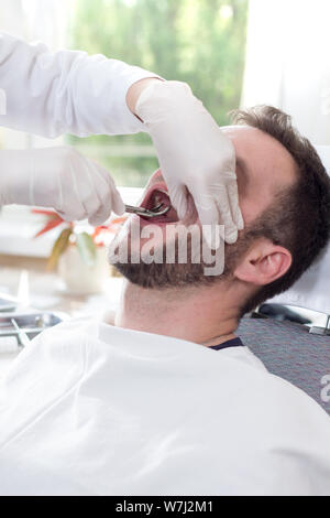 L'uomo bianco che è seduto su una poltrona odontoiatrica con la bocca aperta. Le mani del dentista in guanti bianchi afferrare il dente con artigli. Foto Stock
