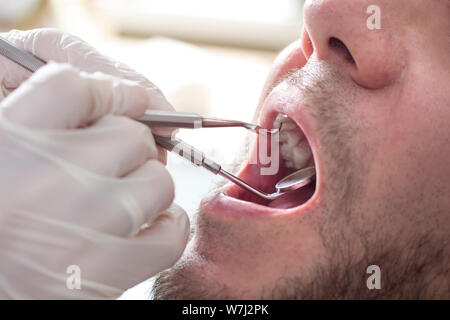 Dentista femmina con le mani in mano tenere il dentale e specchio di escavatore. Un uomo è seduto su una poltrona odontoiatrica con una bocca aperta. Foto Stock