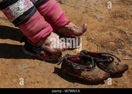 Un'anziana donna cinese mostra il suo legato in piedi Weining Yi, Hui, e Miao contea autonoma, Bijie city, a sud-ovest della Cina di Guizhou, 19 aprile Foto Stock