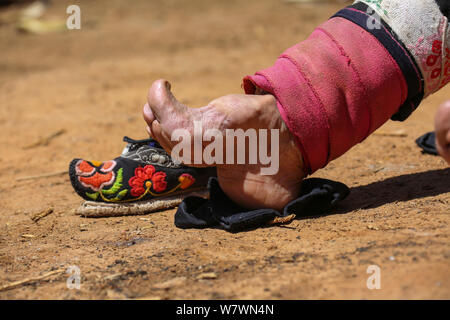 Un'anziana donna cinese mostra il suo legato in piedi Weining Yi, Hui, e Miao contea autonoma, Bijie city, a sud-ovest della Cina di Guizhou, 19 aprile Foto Stock