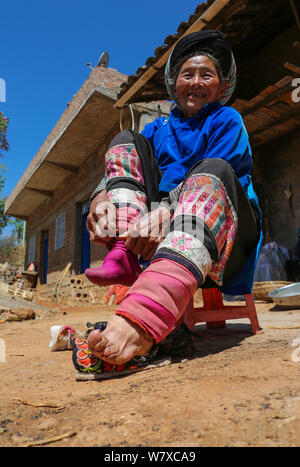 Un'anziana donna cinese mostra il suo legato in piedi Weining Yi, Hui, e Miao contea autonoma, Bijie city, a sud-ovest della Cina di Guizhou, 19 aprile Foto Stock