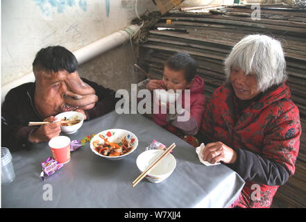 "La Cina Elephant Man' Huang Chuncai, 41, chi soffre di 15kg enorme tumore sul viso, mangia il pranzo con sua madre e suo nipote a casa in villa Yulan Foto Stock