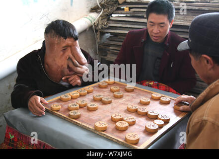 "La Cina Elephant Man' Huang Chuncai, 41, chi soffre di 15kg tumore enorme sulla faccia, gioca a scacchi cinesi con gli abitanti di un villaggio a casa nel villaggio di Yulan, Foto Stock