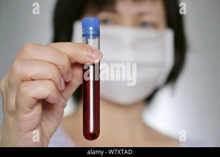 Donna in maschera medica con una provetta in mano. Concetto di campione di sangue, Medico, scienziato, la ricerca medica Foto Stock